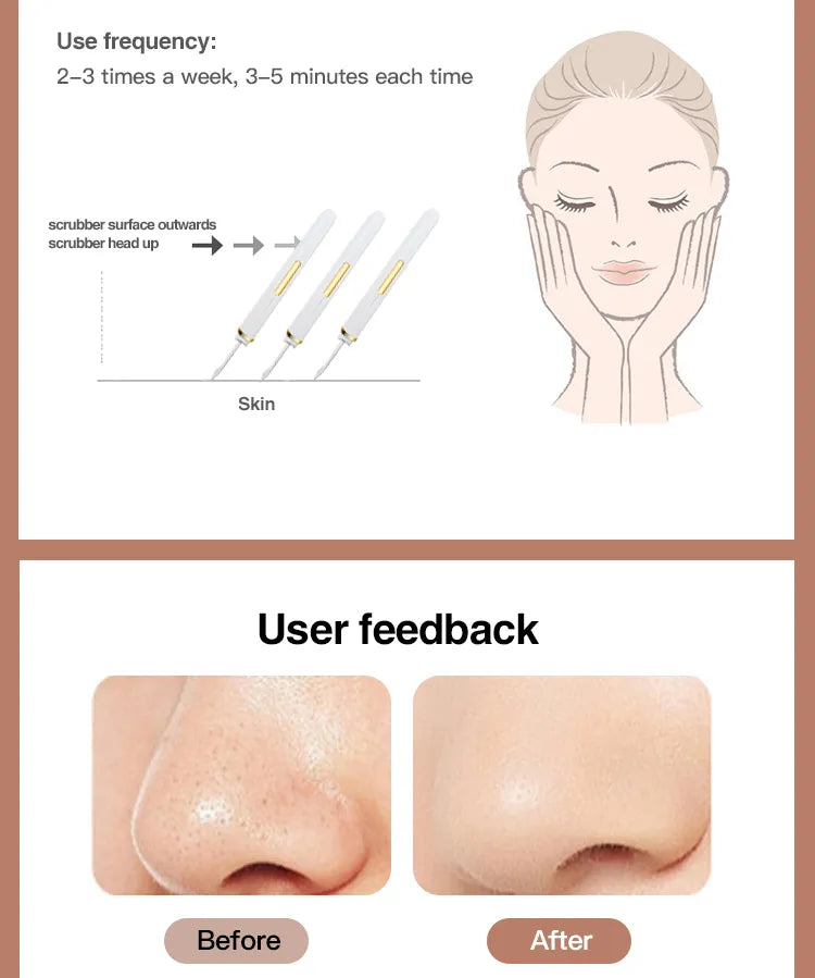 Soth Ultrasonic Vibrating Scrubber