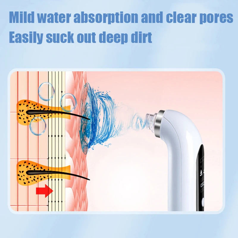 YMD Blackhead Remover Pore Vacuum