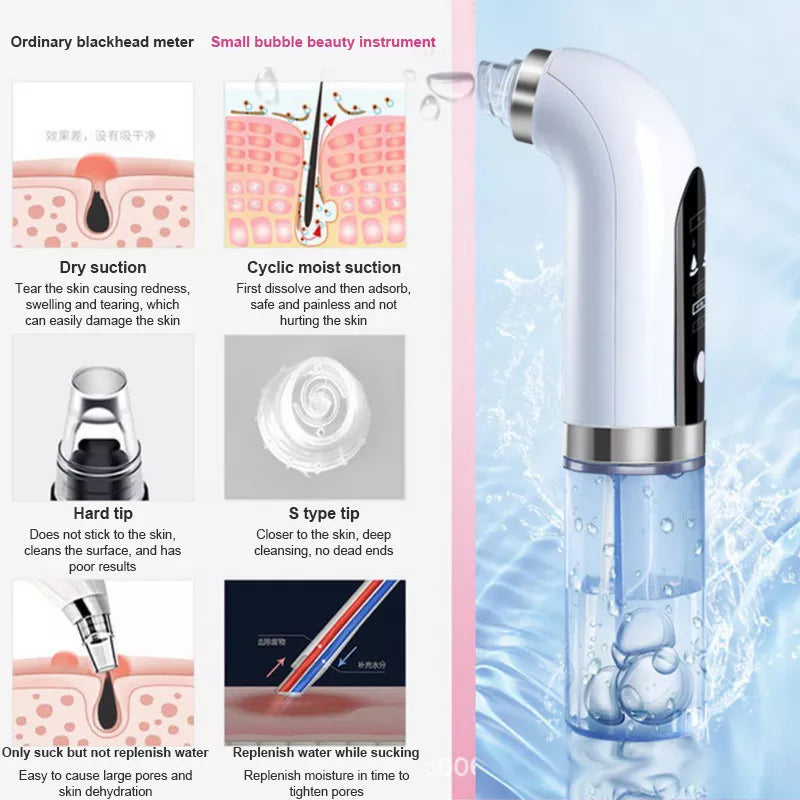 YMD Blackhead Remover Pore Vacuum
