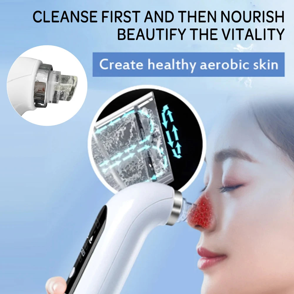 YMD Blackhead Remover Pore Vacuum