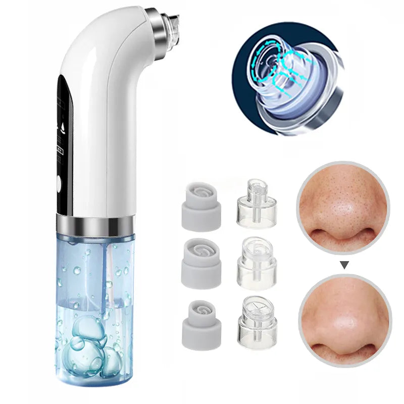 YMD Blackhead Remover Pore Vacuum