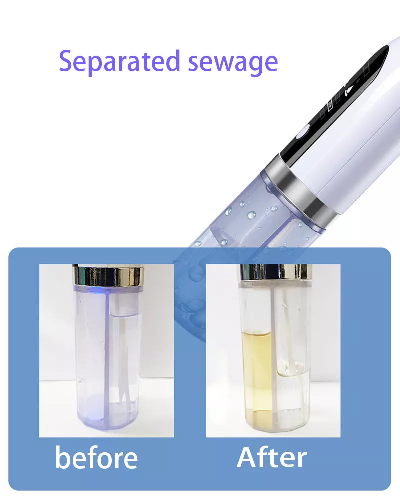 YMD Blackhead Remover Pore Vacuum
