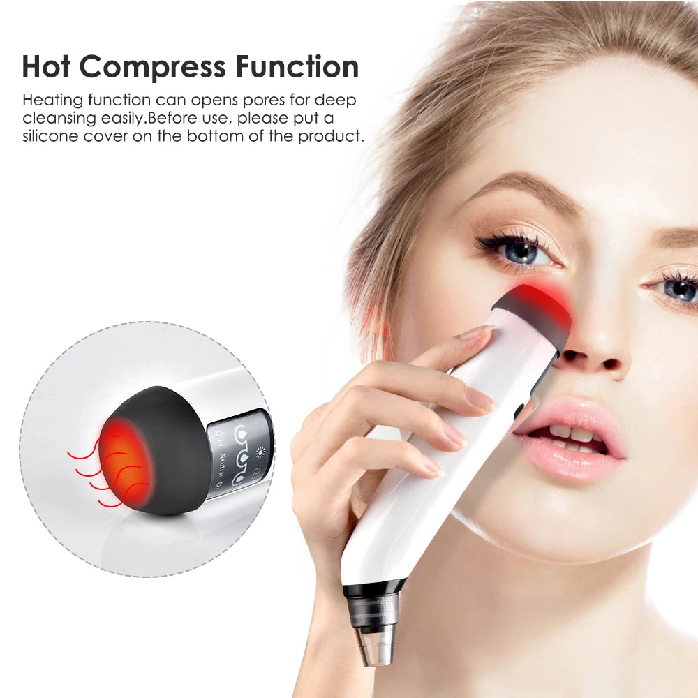 BW Blackhead Remover
