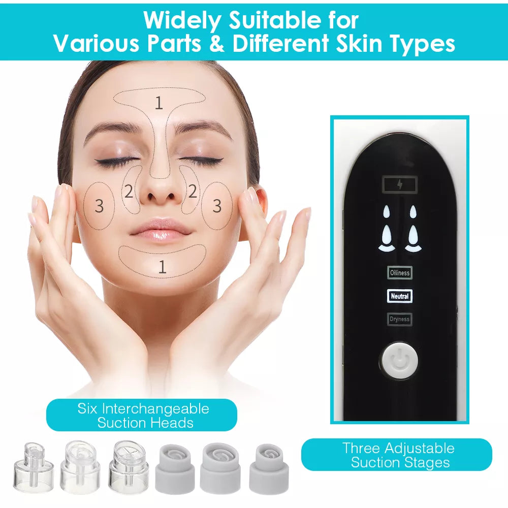 YMD Blackhead Remover Pore Vacuum